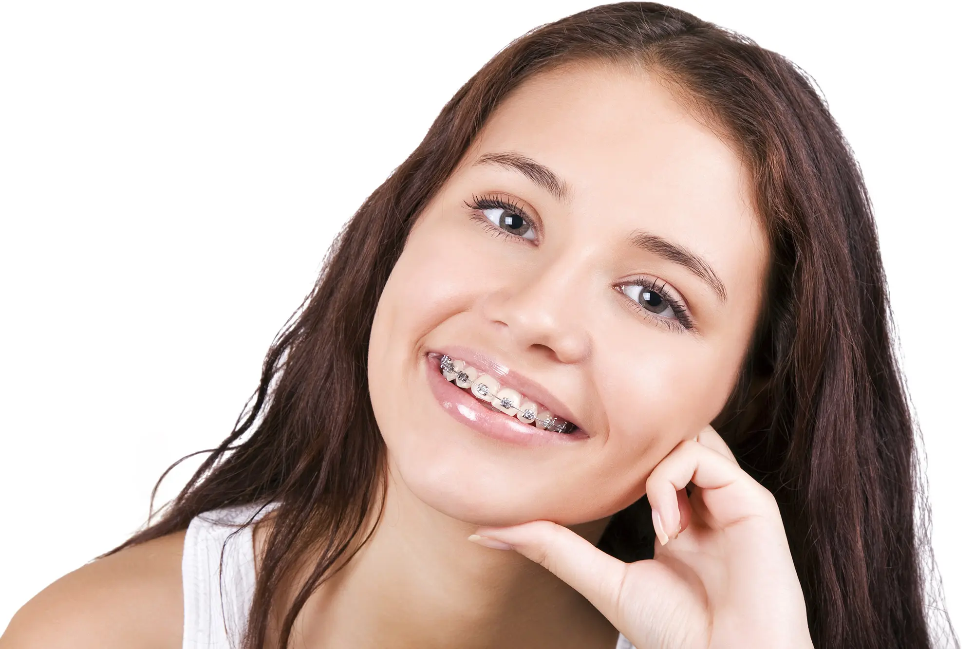 What to know before getting braces? The patient’s perspective.