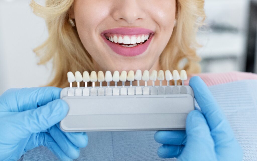 teeth whitening