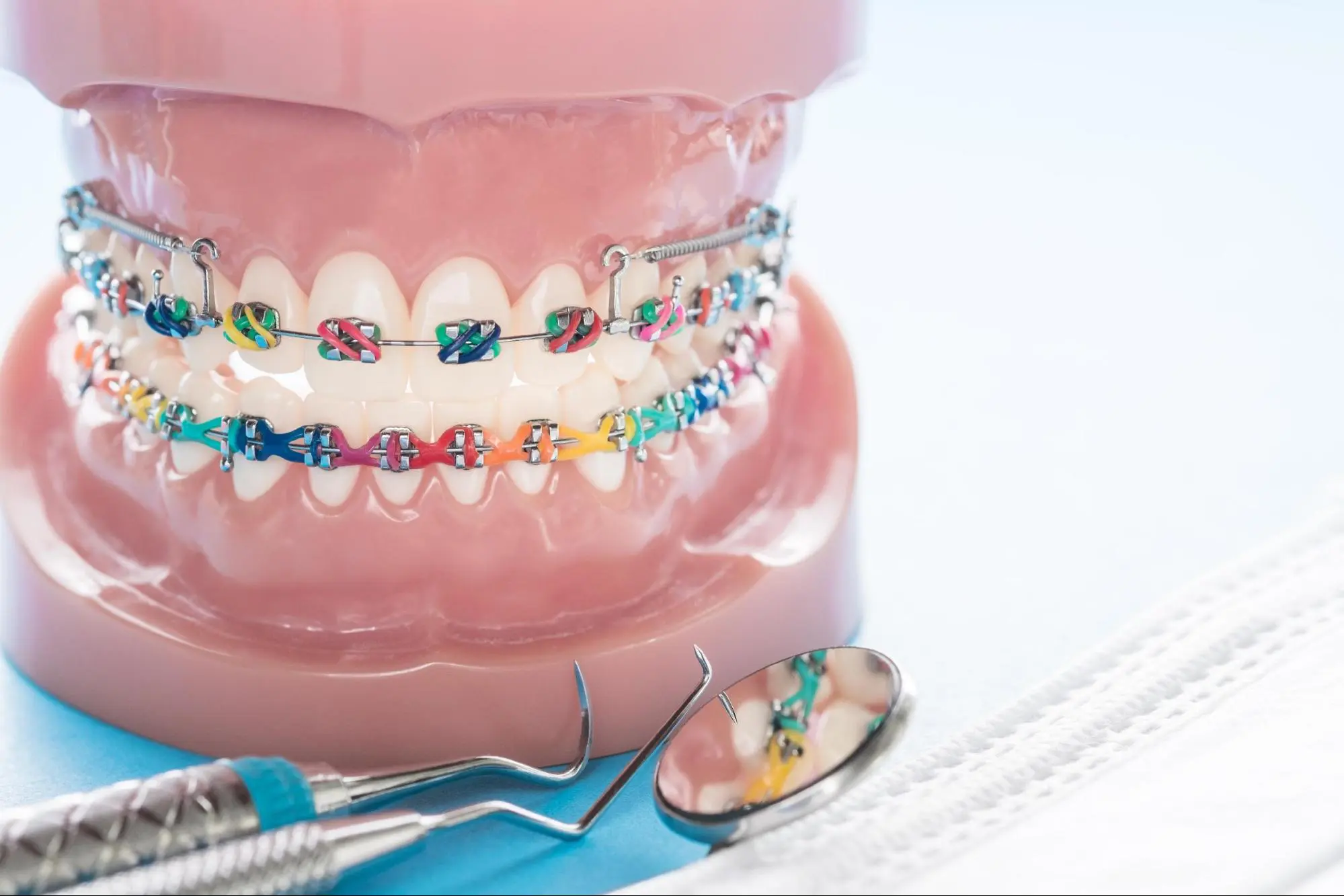 How long do I have to wear dental braces?