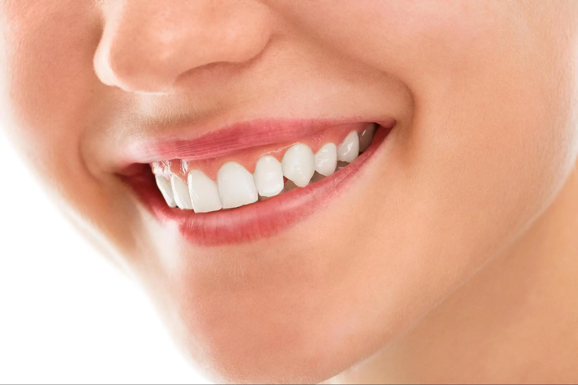 Show off a more beautiful smile with Gingivectomy,