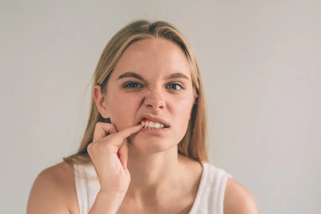 Gum abscess stages and treatment
