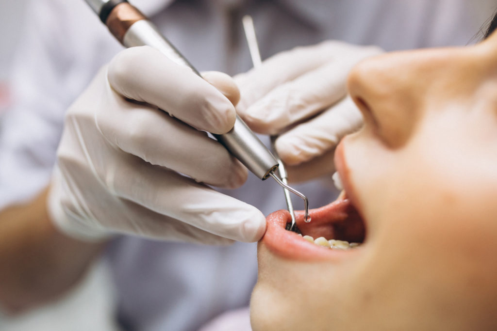 paciente mujer en el dentista escuchando las diferencias entre endodoncia, corona y como son las coronas dentales