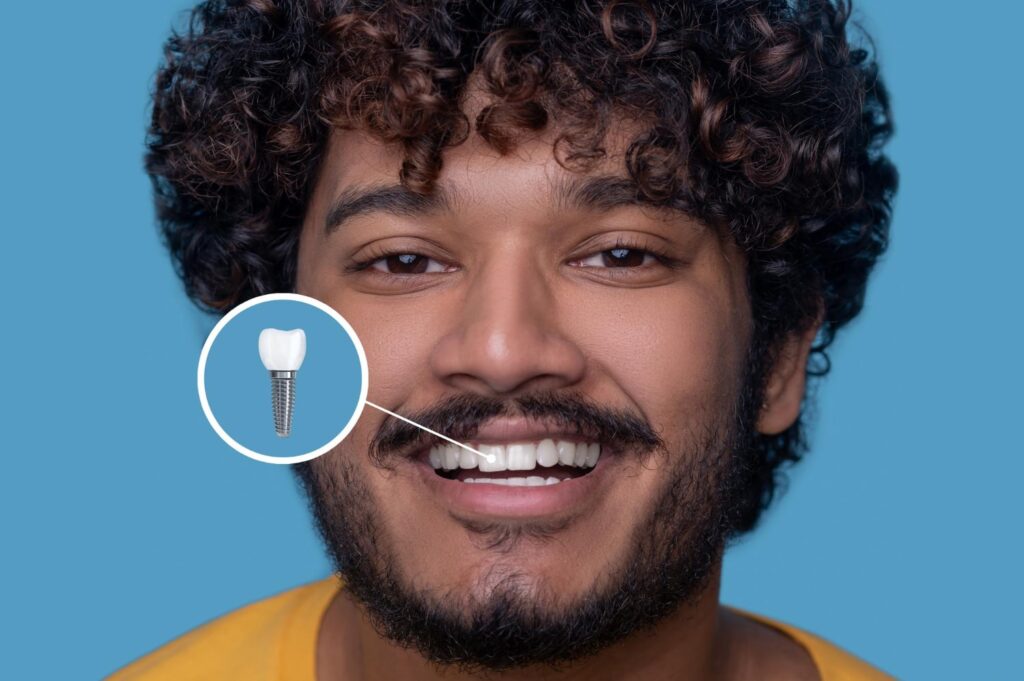 hombre latino joven sonriendo mostrando un tapon de cicatrizacion de implantes dentales