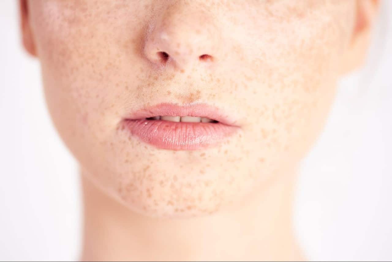 Mouth cancer symptoms