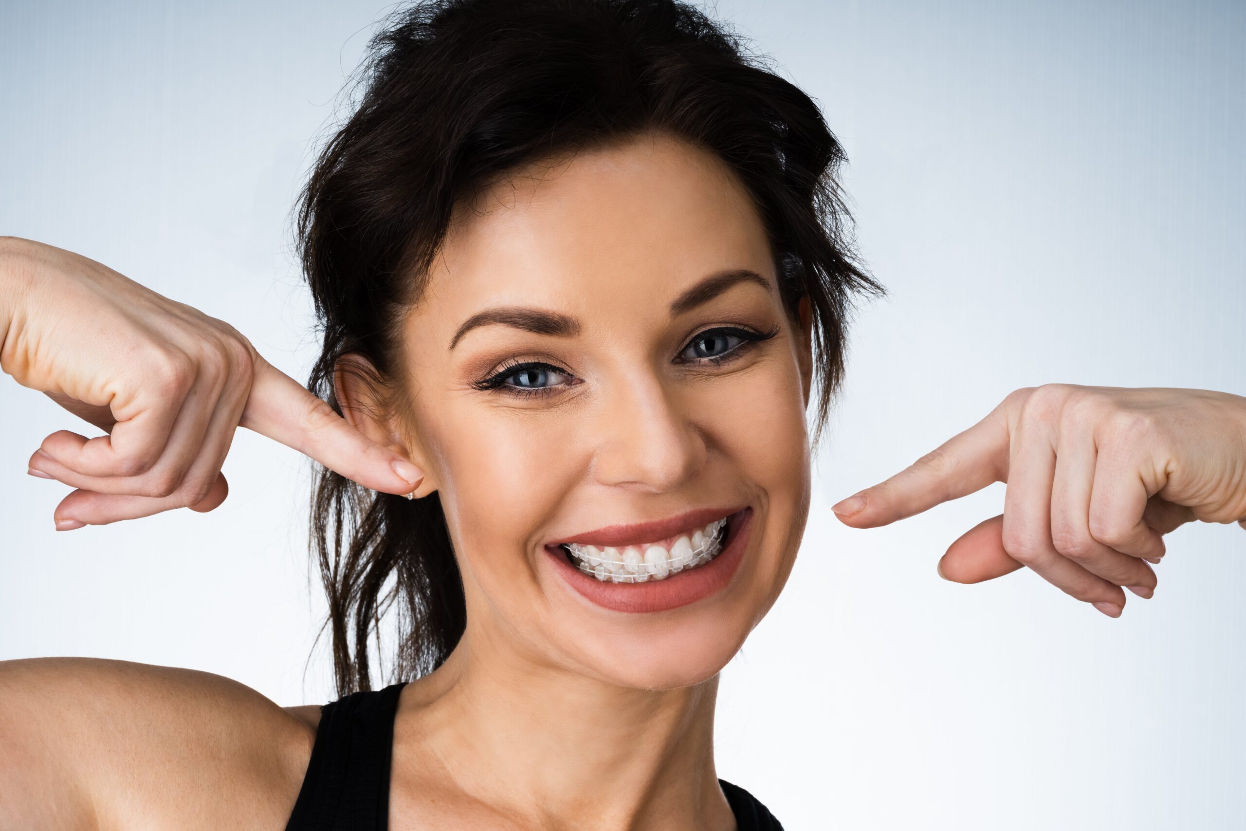 De que material estan hechos los brackets? – Somos Dental