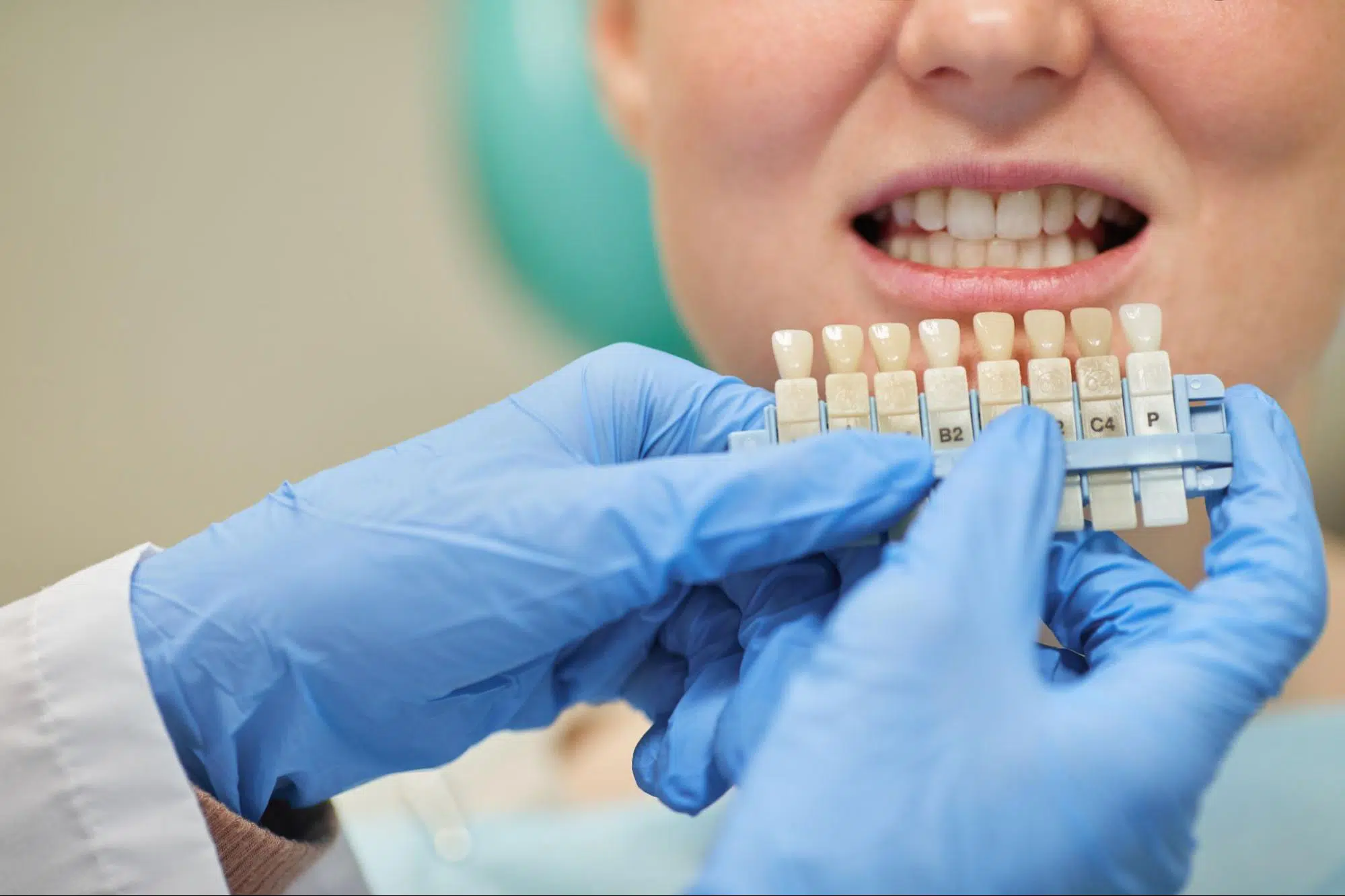 ¿Cuáles son los diferentes tipos de implantes dentales?
