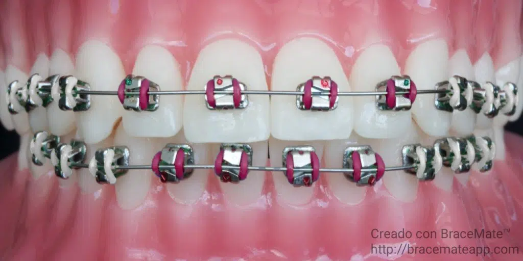 front teeth