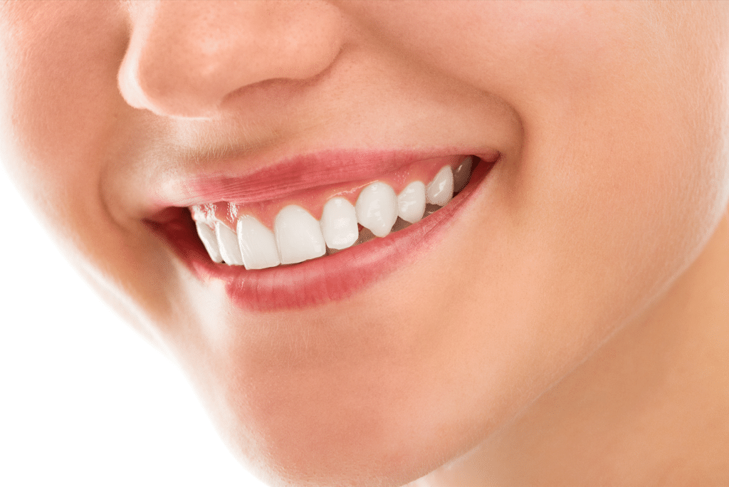 Cosmetic Dental Teeth Whitening