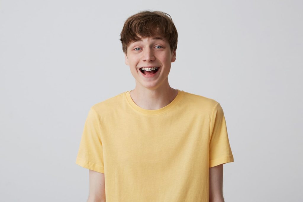 smiling excited blond young man with short haircut metal braces teeth wears yellow t shirt looks happy knowing how long does it take to put braces on