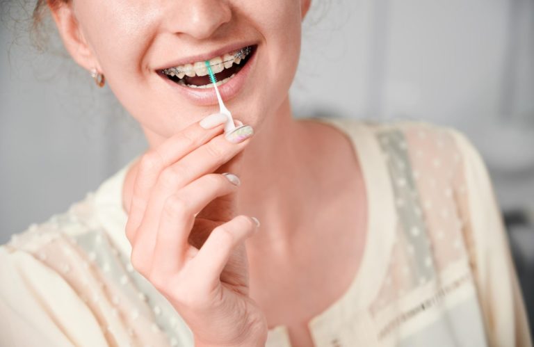 young woman with braces on teeth using elastic cleaning toothpick happy to know if can you chew gum with braces