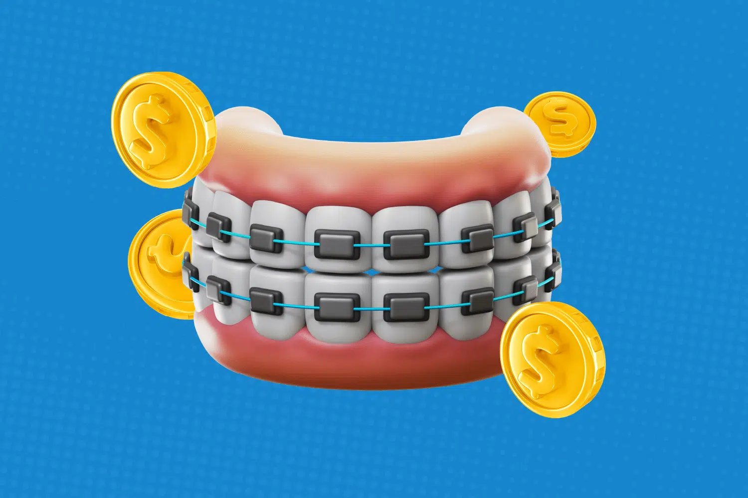 How Much Do Braces Cost in the USA?