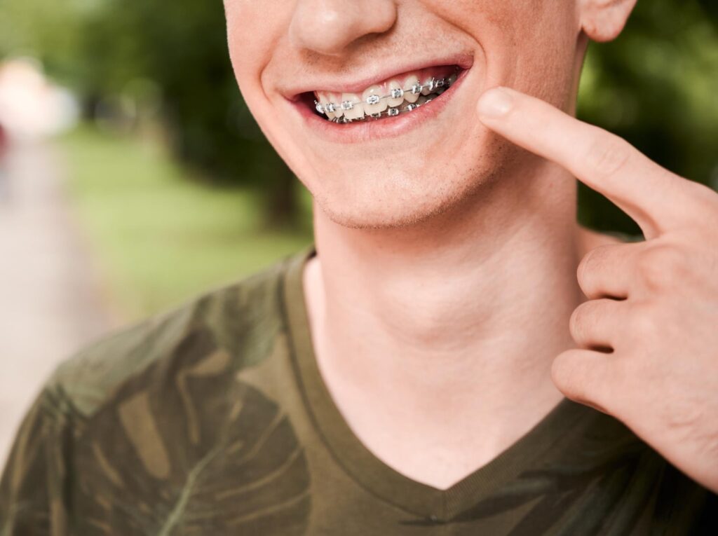 Portrait of a young man smilling and showing her orthodontic and explaining when do braces start working