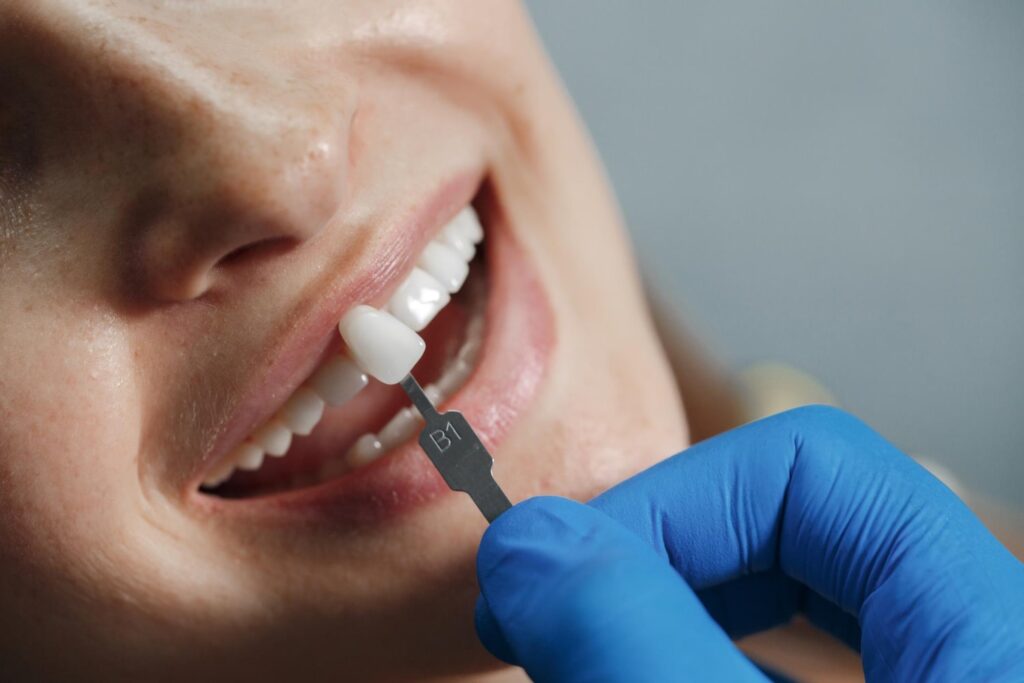 dentist whiting teeth explaining how long do crowns last on teeth