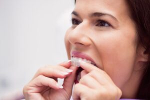 female patient showing his orthodontic to explain are braces cheaper than Invisalign