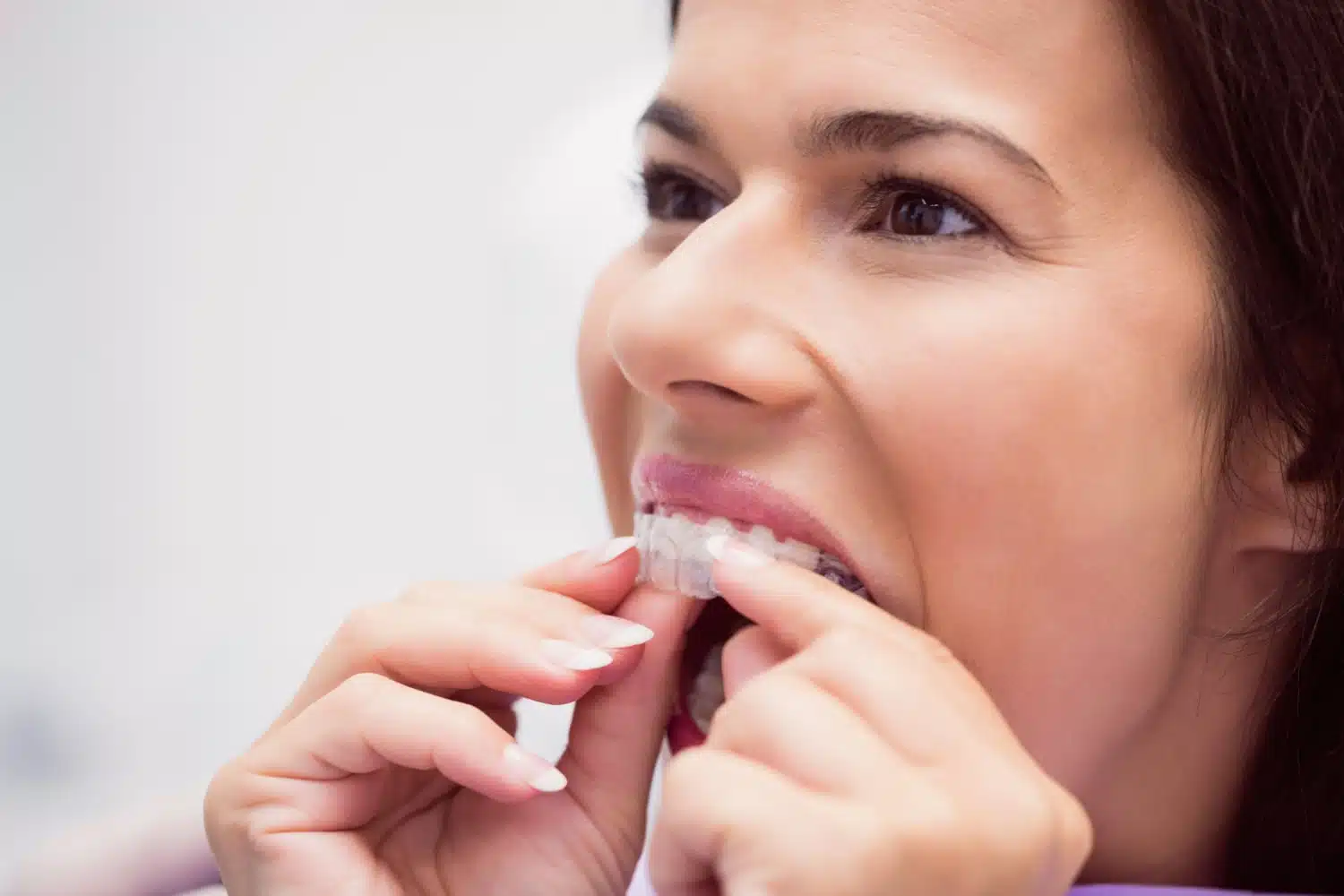 Are braces cheaper than Invisalign? Which is better?