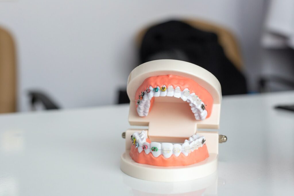 artificial denture with dental braces in dentist office to explain how long does it take to get braces off