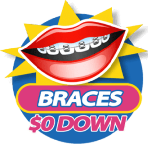Affordable dental Braces at Somos Dental in phoenix