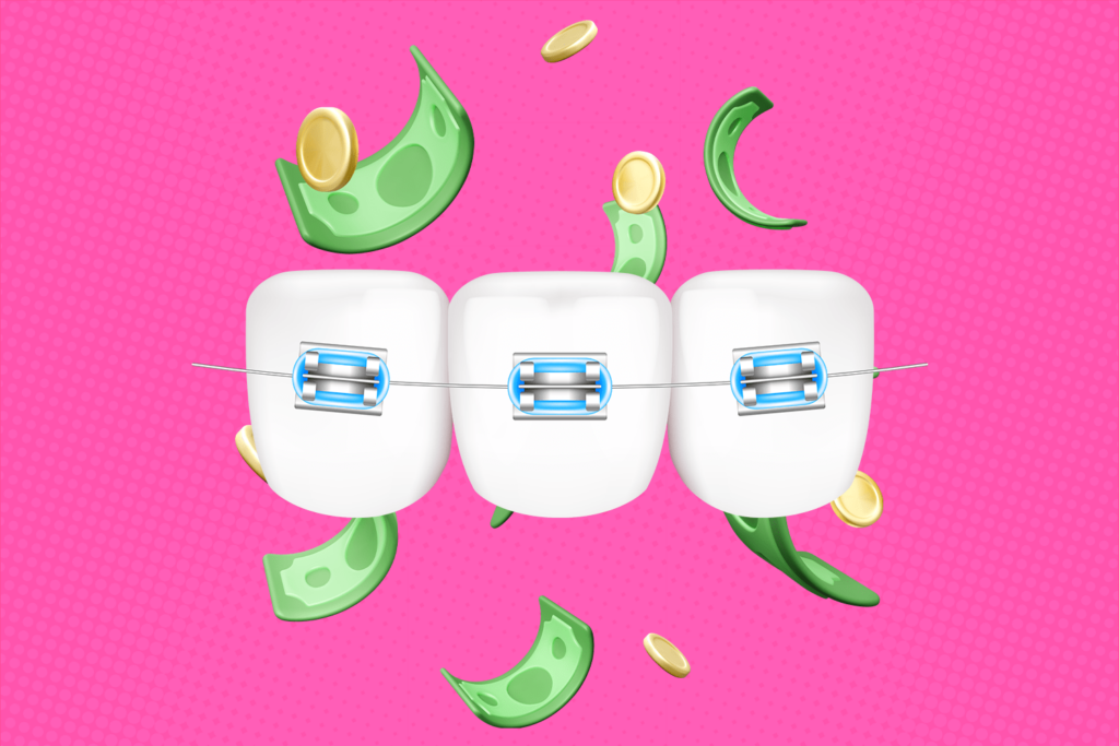 Illustration 3D of teeth with braces with money bills around to exemplify where can I get affordable braces