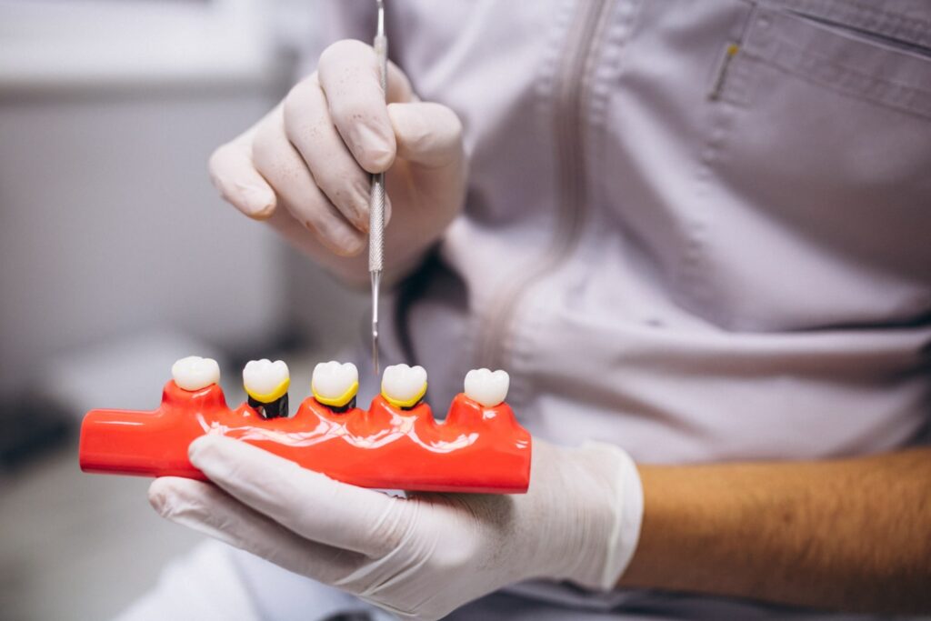 Dentist showing a set of artificial teeth to show a tooth crown replacement
