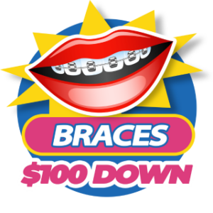 Braces-100-down