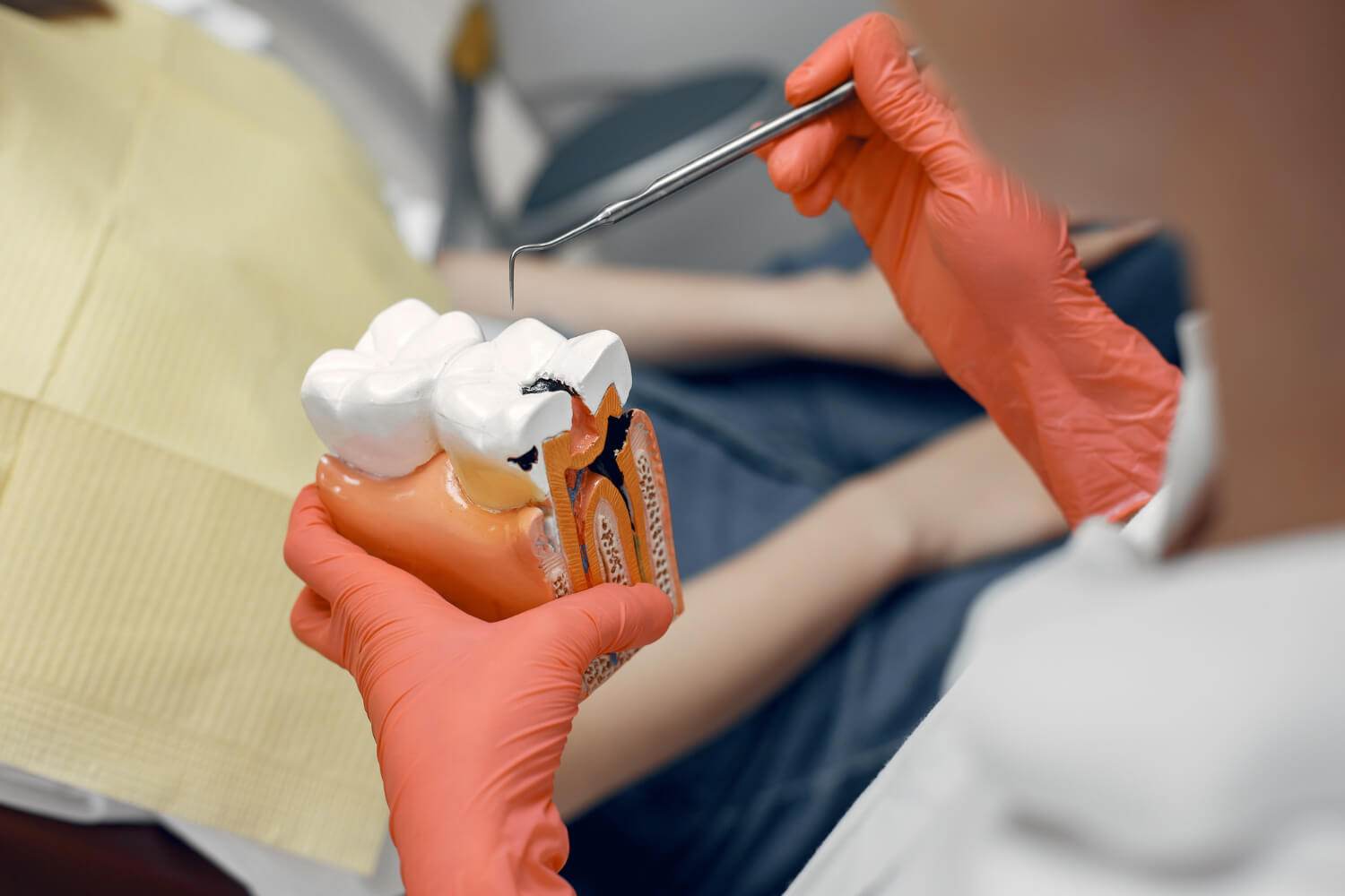 Modelo de un diente para explicar que es una endodoncia y como se dice endodoncia en ingles