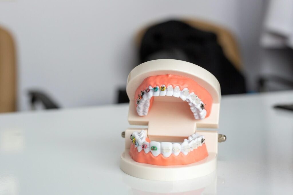 Dentures with braces at a dental clinic to explain when are braces medically necessary