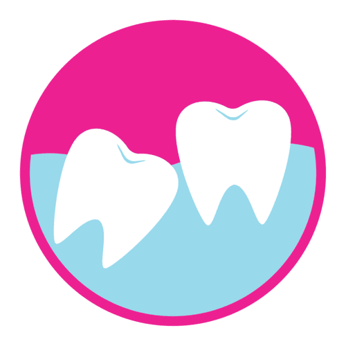 affordable wisdom teeth removal