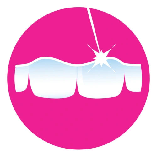 affordable gingivectomy at somos dental