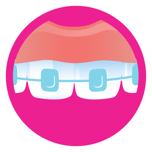 affordable braces icon