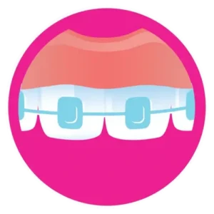 affordable braces icon