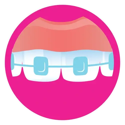 affordable braces icon